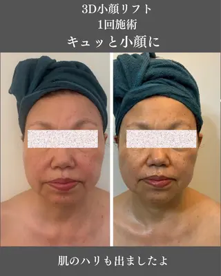 オールハンド筋膜痩身 整体/小顔　中山朝美のエステ・リラクイメージ