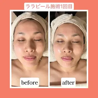 💜Karen PrivateSpaのエステ・リラクイメージ