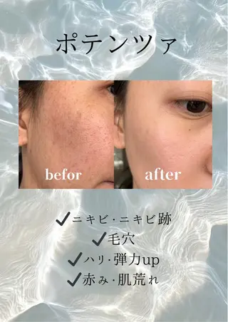 マツエク・マツパ 愛維美水光美肌専門店 メンズレディースokのエステ・リラクイメージ