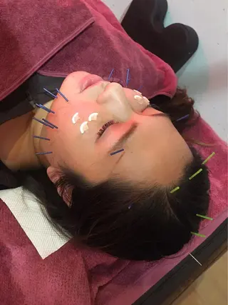 美容鍼灸女性専用 りんご鍼灸治療院のエステ・リラクイメージ