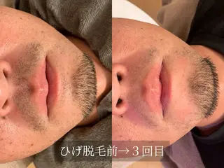 脱毛サロン Arumのエステ・リラクイメージ