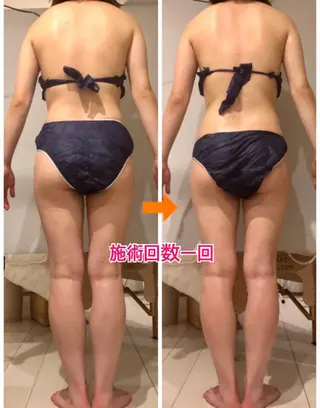 ロング カラー パーマ ヘアアレンジ メンズ キッズ ネイル マツエク・マツパ ‍痩身＆ボディ 結果出し🌟丹野のエステ・リラクイメージ