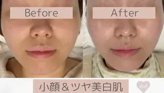 小顔/毛穴/ニキビ salon bealのエステ・リラクイメージ