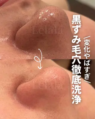 Salon Lelalaのエステ・リラクイメージ