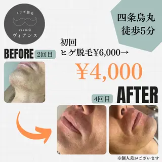 メンズ メンズ脱毛ヴィアンス fujitaのエステ・リラクイメージ