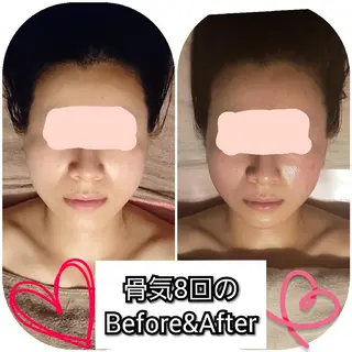 たるみ・ くすみ シミ・ニキビ肌改善のエステ・リラクイメージ