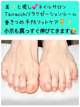 ネイル Tairacchi ﾀｲﾗｯﾁのエステ・リラクイメージ