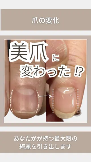ネイル KIKOA NAIL キコアネイルのネイルデザイン