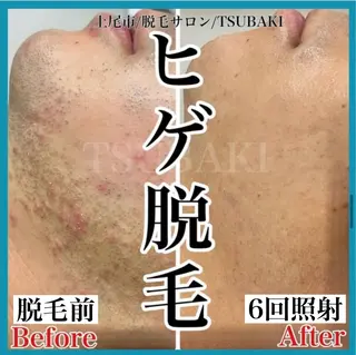 メンズ TSUBAKI上尾店 松下のエステ・リラクイメージ