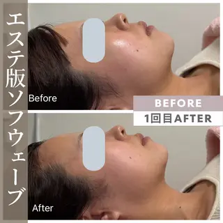 小顔矯正・美肌ケア 池田 桃花のエステ・リラクイメージ