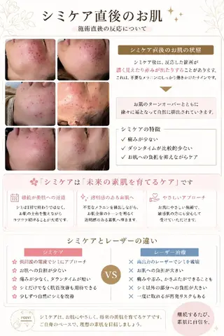 SPOT.com  シミケア専門店のエステ・リラクイメージ