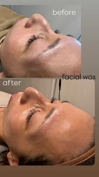 なみ|WAX脱毛専門 店|さいたま市のエステ・リラクイメージ