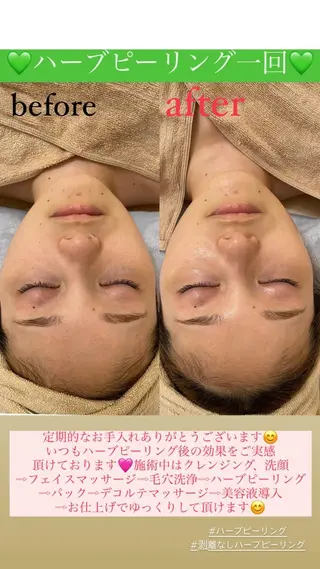 メンズ Salon de Lino 御器所のエステ・リラクイメージ
