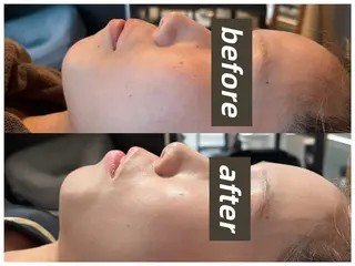 浮腫|肩こり|張り 日々の疲れを解消★のエステ・リラクイメージ