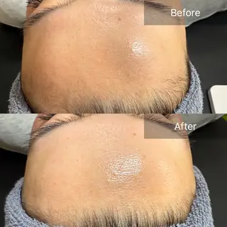 enine フェイスWAXのエステ・リラクイメージ