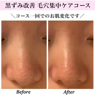 Bellesthe (ベルエステ)のエステ・リラクイメージ