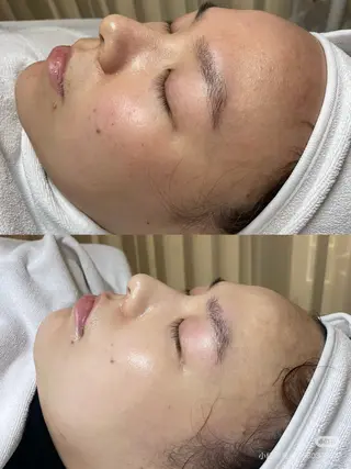 ネイル 愛維美水光専門店 川崎彩鳳のエステ・リラクイメージ