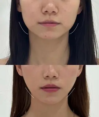 マツエク・マツパ 愛維美水光専門店 川崎彩鳳のエステ・リラクイメージ