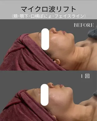 オンダリフト小顔･ ワックス脱毛×光脱毛のエステ・リラクイメージ