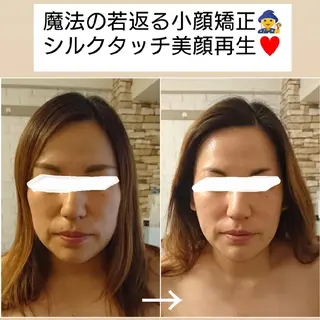 小顔美容整体& 美爪育成Jelissのエステ・リラクイメージ