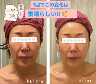 35歳からの エイジングケアサロンのエステ・リラクイメージ