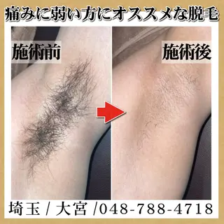 脱毛 TOWA大宮のエステ・リラクイメージ