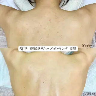 肌質改善サロン renew/ウエキのエステ・リラクイメージ