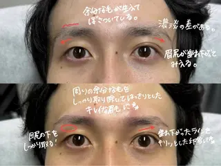 アイブロウ HIROMU ｜メンズ眉毛の眉毛・アイブロウイメージ