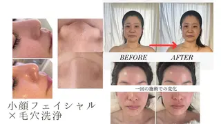 千葉小顔フェイシャル Salondesoéのエステ・リラクイメージ