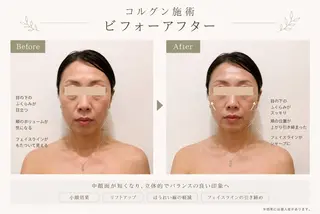Lino 韓国コルグン×美肌のエステ・リラクイメージ