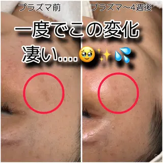 お顔剃りエステサロン SHECIAのその他イメージ