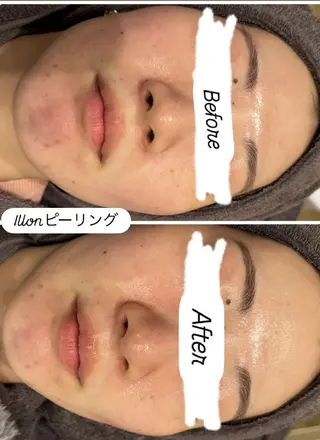 看護師 桐山 まどかのエステ・リラクイメージ