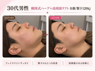 メンズ 韓国肌管理Belle 静岡 前田のエステ・リラクイメージ