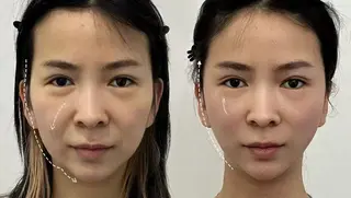 ネイル 愛維美水光専門店 川崎彩鳳のエステ・リラクイメージ