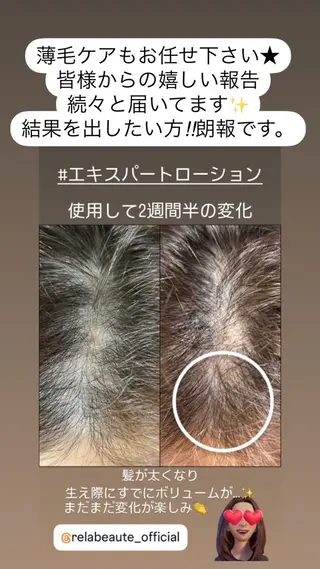 LiZA エステティックサロンのエステ・リラクイメージ