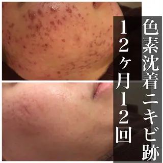 ミディアム カラー パーマ ヘアアレンジ メンズ キッズ ネイル マツエク・マツパ ニキビ・肌質改善専門 ♡人生が変わるサロンのエステ・リラクイメージ