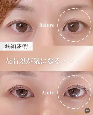 マツエク・マツパ 似合わせまつパ︎︎ 👀 ︎ /Otoeのマツエク・マツパデザイン
