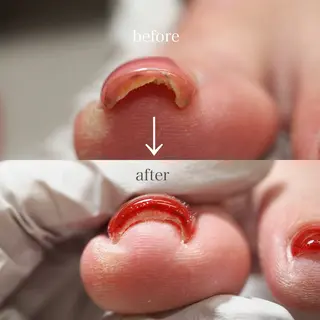 ネイル ソアネイル スタッフのネイルデザイン