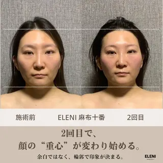 麻布十番小顔コルギ 姿勢矯正リアン💗のエステ・リラクイメージ