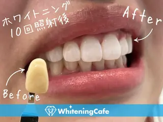 ホワイトニングカフェ 徳島沖浜店のその他イメージ