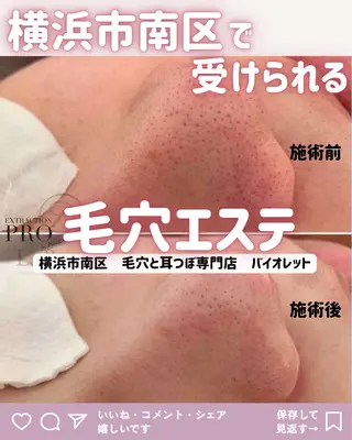 毛穴と耳つぼ専門店 バイオレット　りののその他イメージ