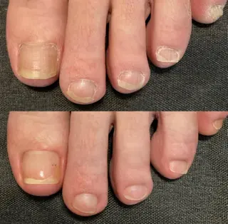 ネイル 地爪育成💅 kanaoanailのネイルデザイン
