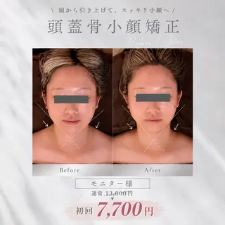 kogao&head Linoasのエステ・リラクイメージ