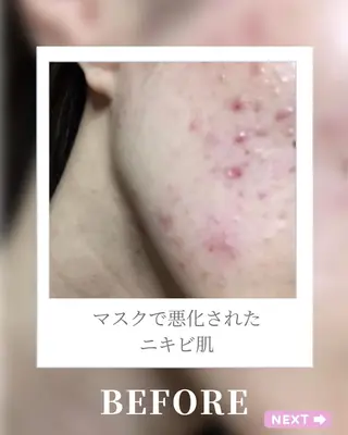 🎀BiBi韓国美容 コスパ強!美活サロンのエステ・リラクイメージ
