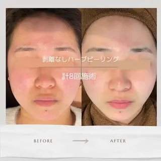 Life Salon別府店のエステ・リラクイメージ