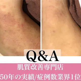 ミディアム カラー パーマ ヘアアレンジ メンズ キッズ ネイル マツエク・マツパ ニキビ・肌質改善専門 ♡人生が変わるサロンのエステ・リラクイメージ