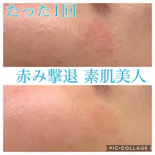 ミディアム カラー パーマ ヘアアレンジ キッズ ネイル マツエク・マツパ EnsorClair 代表 野口真央のエステ・リラクイメージ