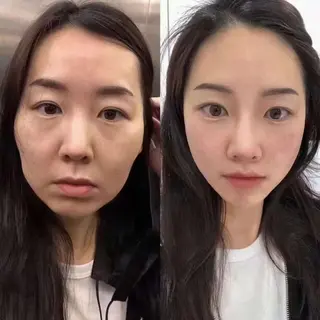 ネイル 愛維美水光専門店 川崎彩鳳のエステ・リラクイメージ