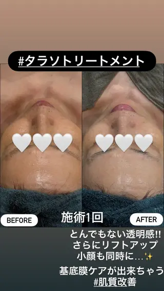LiZA エステティックサロンのエステ・リラクイメージ