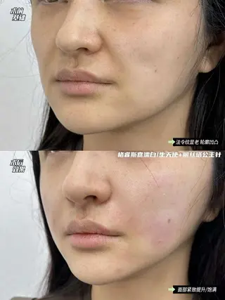 マツエク・マツパ 愛維美水光専門店 川崎彩鳳のエステ・リラクイメージ